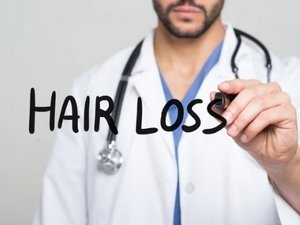Top 5 reasons for hair loss - niostem